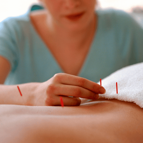 behandeling acupunctuur