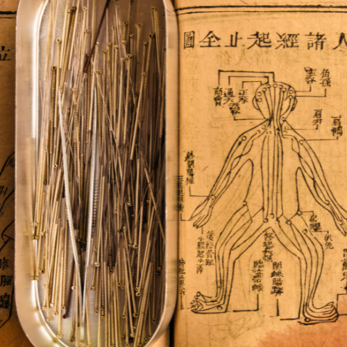 chinese geneeskunde acupunctuur