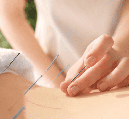 Acupunctuur Rozenburg