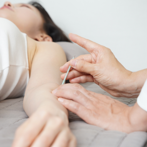 behandeling van zenuwpijn met acupunctuur