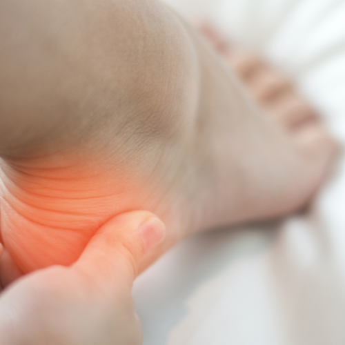 Acupunctuur bij hielspoor in Brielle